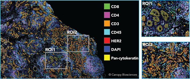 Highly multiplexed image of breast cancer sample.