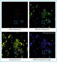 HDR immunofluorescence microscopy image